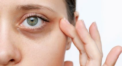 Tus ojeras no necesitan un corrector, necesitan vacaciones