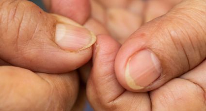 Despídete de las uñas amarillas gracias a estos 3 remedios naturales