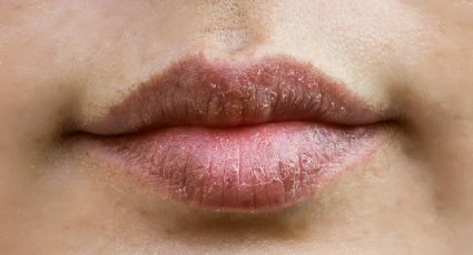 El truco casero para mantener hidratados los labios agrietados