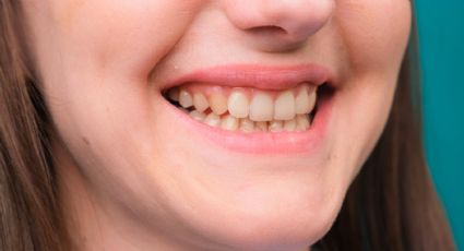 Cómo quitar el color amarillo de los dientes con estos trucos naturales