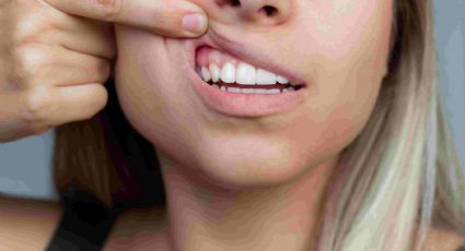 Los alimentos ideales para mejorar la calidad del esmalte dental